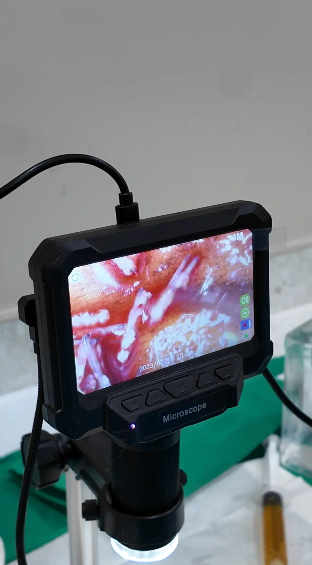 Trichoscopy screen showing a magnified view of scalp and hair during a consultation at Thrive Hair Clinic