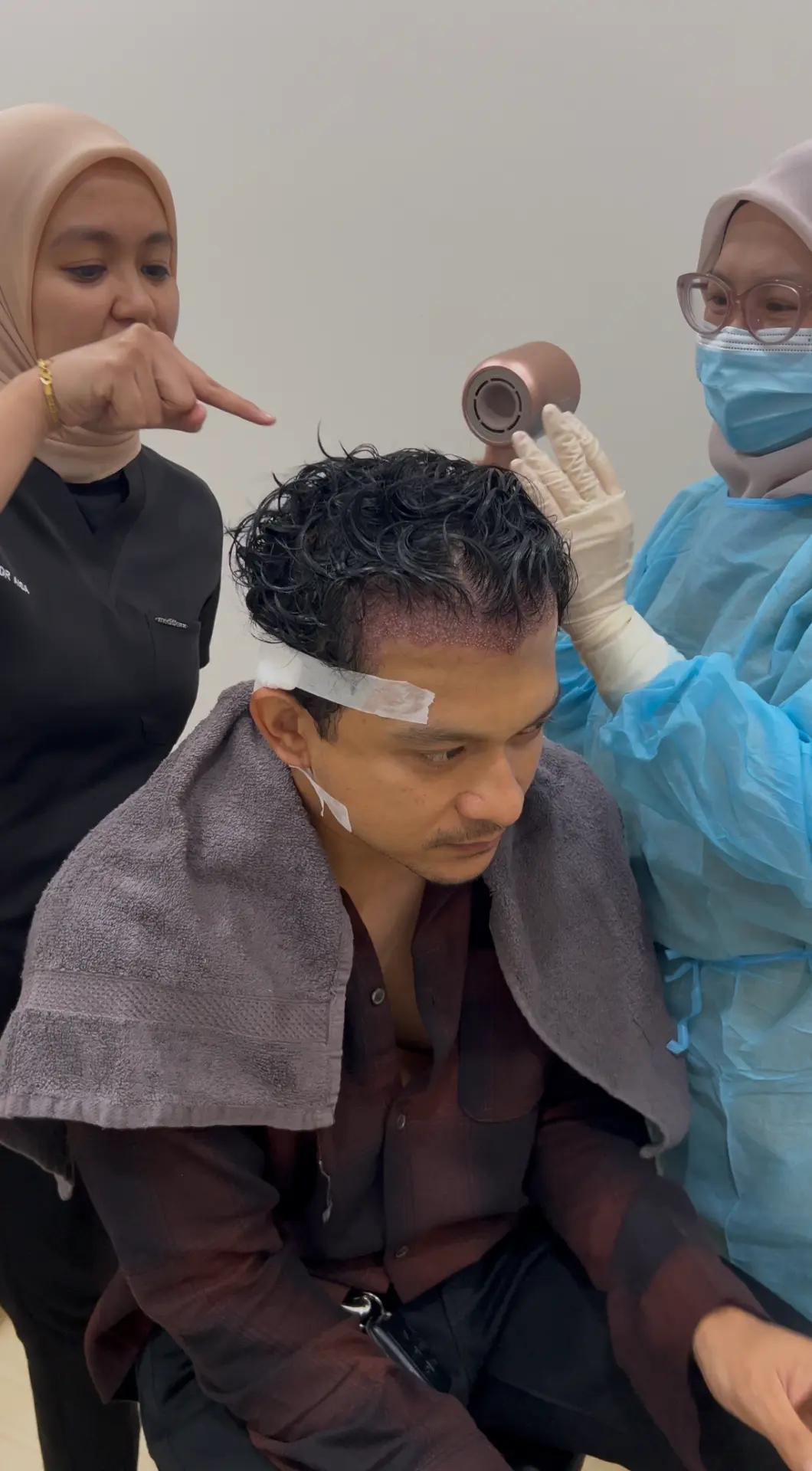 Careful drying of the newly implanted hairline during a follow-up visit
