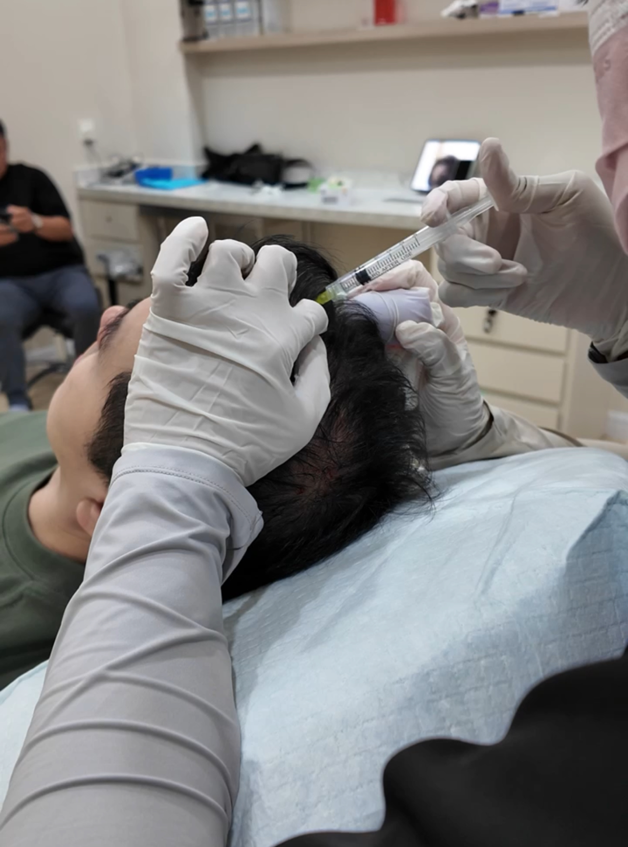 Close-up of a regenerative scalp injection into a thinning area
