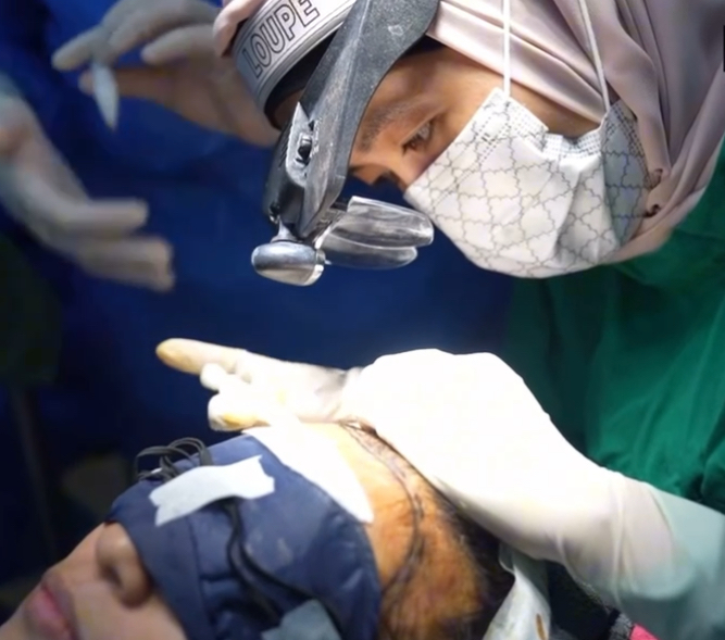 Dr Aisa performing a hair transplant procedure under surgical loupes at Thrive Hair Clinic