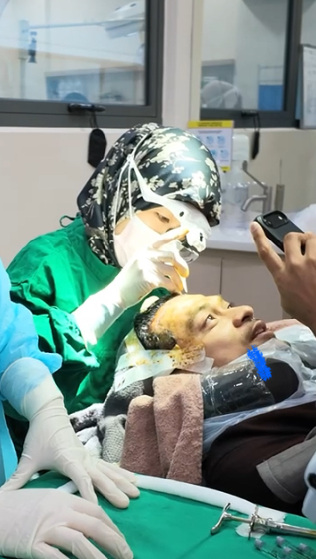 Thrive doctor performing hairline surgery on a patient